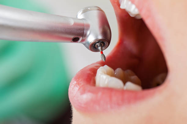 Best Emergency Treatment for Dental Infections or Abscesses in Oak Harbor, OH